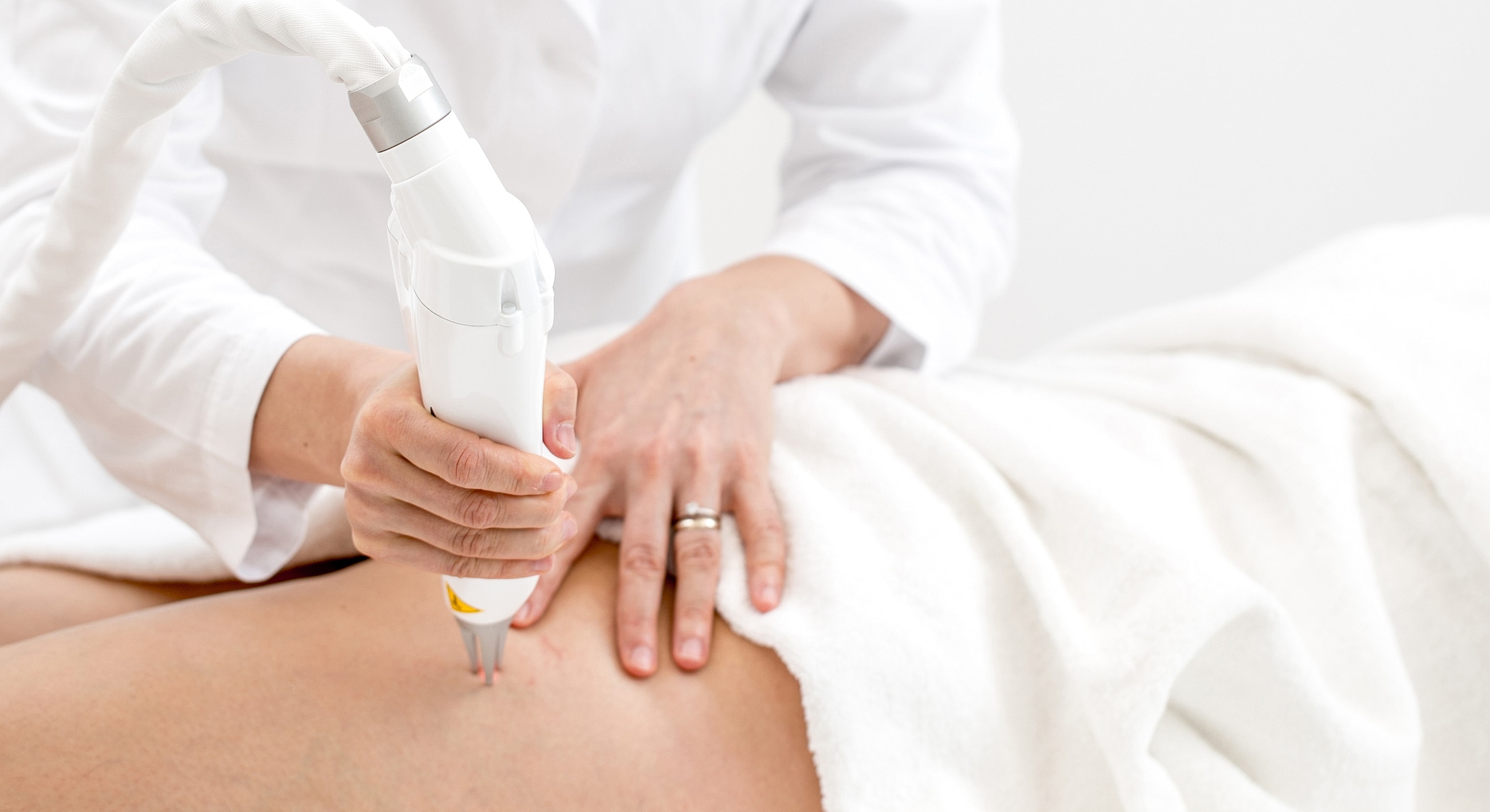 Roswell Laser Vein Removal model receiving treatment