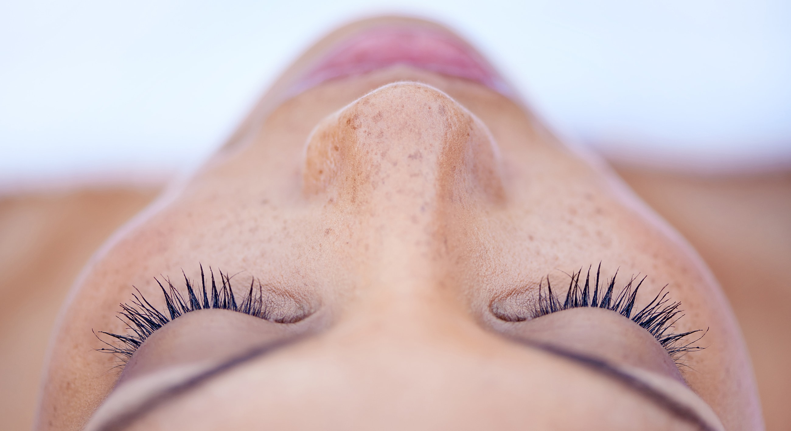 Roswell Latisse model with freckles