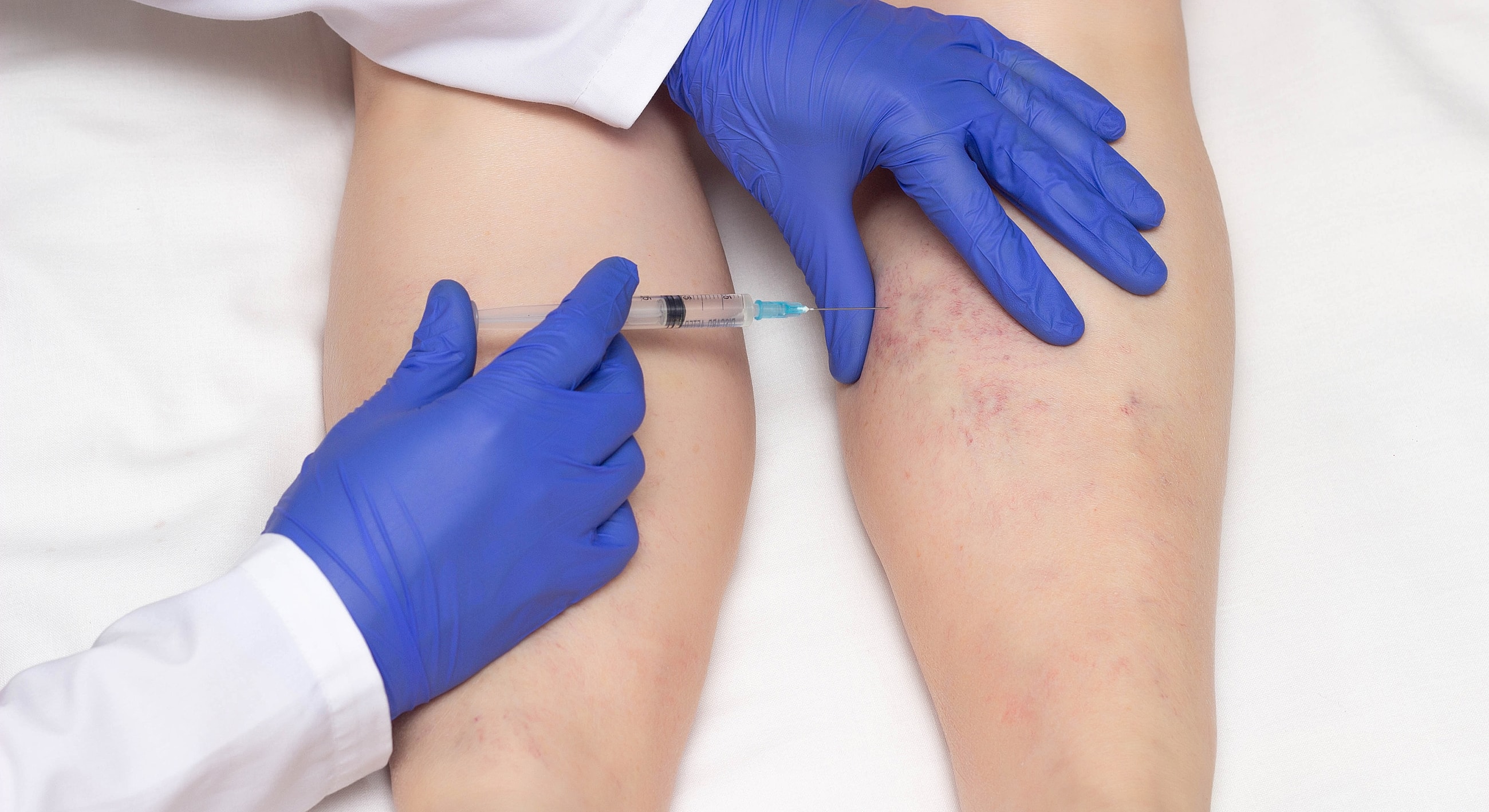 Medical professional administering injection to patient's leg.